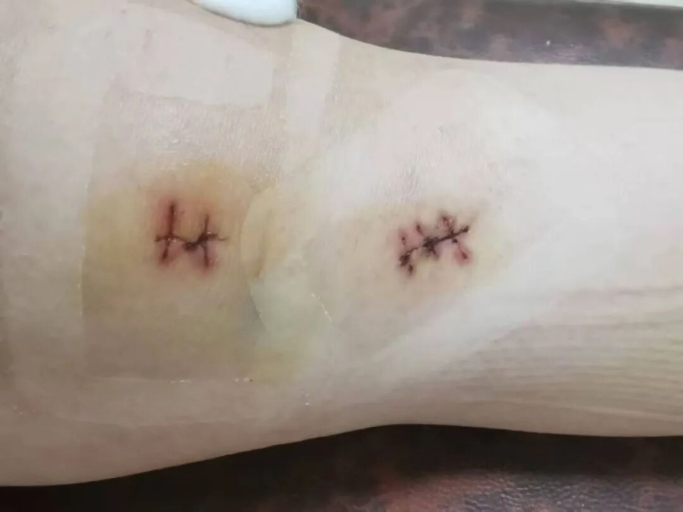 来源, 段与伤病硬, 踢腿稳扎稳 来源, 段与伤病硬, 踢腿稳扎稳